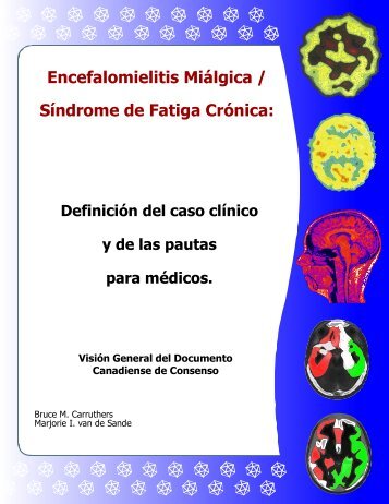 Encefalomielitis Miálgica / Síndrome de Fatiga Crónica: Visión ...