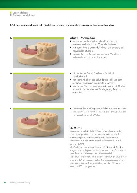 Basisinformationen zu den prothetischen Verfahren - Straumann