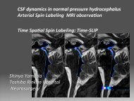 CSF dynamics in normal pressure hydrocephalus Arterial Spin ...