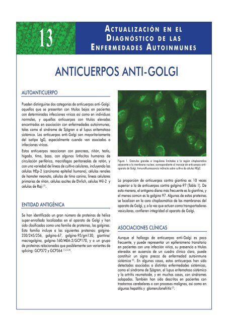 13-anticuerpos anti-golgi