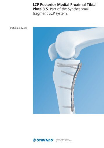 LCP Posterior Medial Proximal Tibial Plate 3.5. Part of the Synthes ...