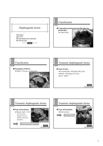 Diaphragmatic hernia Classification Classification Traumatic ...