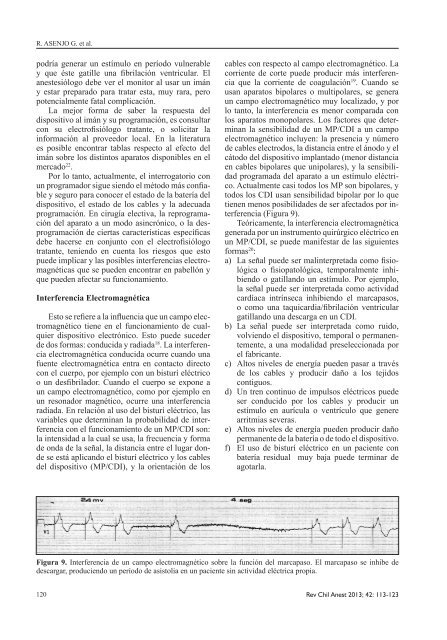 Anestesia en Paciente Portador de Marcapasos Cardiaco y ...