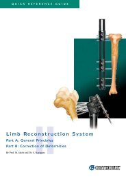 Limb Reconstruction System - Orthofix.com