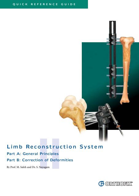 Limb Reconstruction System - Orthofix.com