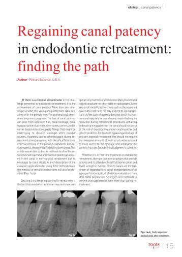 Regaining canal patency in endodontic retreatment - De Vos Endo BV