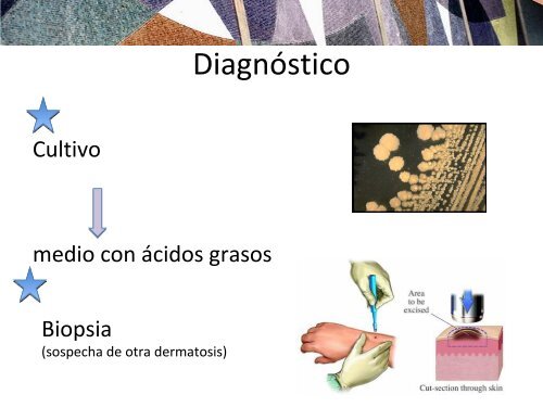 caso foliculitis por malasezzia.pdf - PIEL-L Latinoamericana