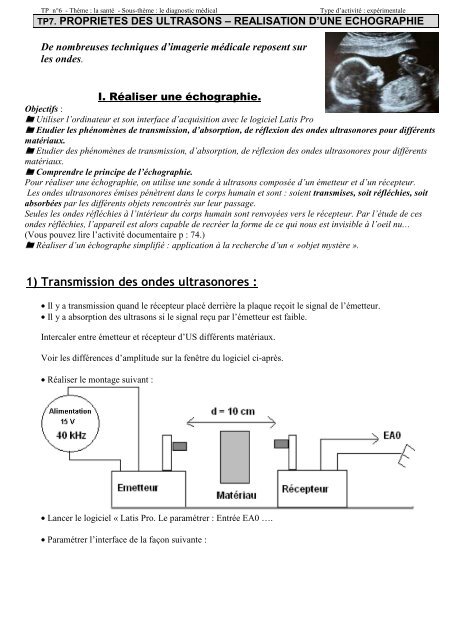 tp7. propriÃ©tÃ©s des ultrasons - rÃ©alisation d?une Ã©chographie