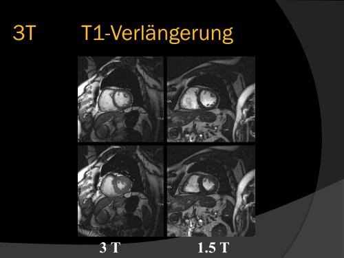 Teil 1