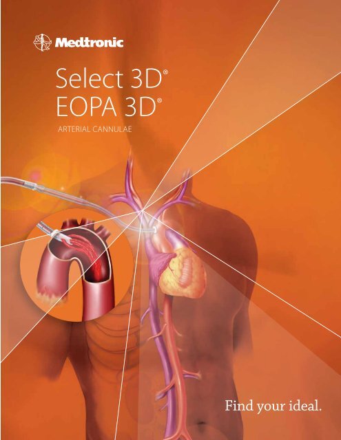 Eopa 3D® artErial CannulaE - Find your ideal - Medtronic