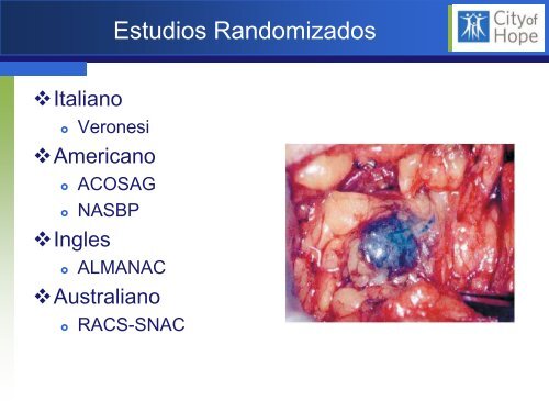 Biopsia del Linfonodo Centinela en CÃ¡ncer de Mama