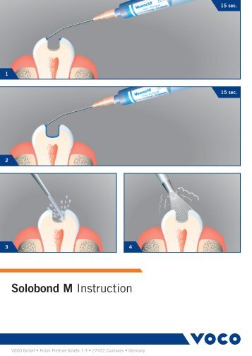 Solobond M Instruction - Voco