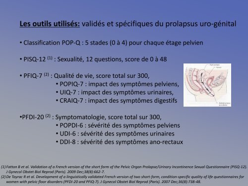 Impact de la chirurgie du prolapsus sur la sexualitÃ© fÃ©minine - FF3S