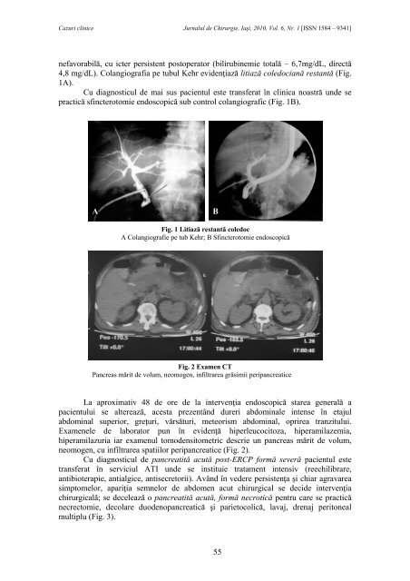 Full text PDF (5 MB) - Jurnalul de Chirurgie