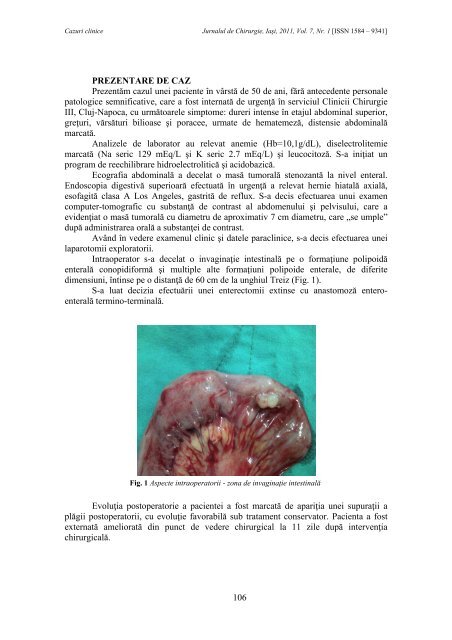 PDF (13 MB) - Jurnalul de Chirurgie