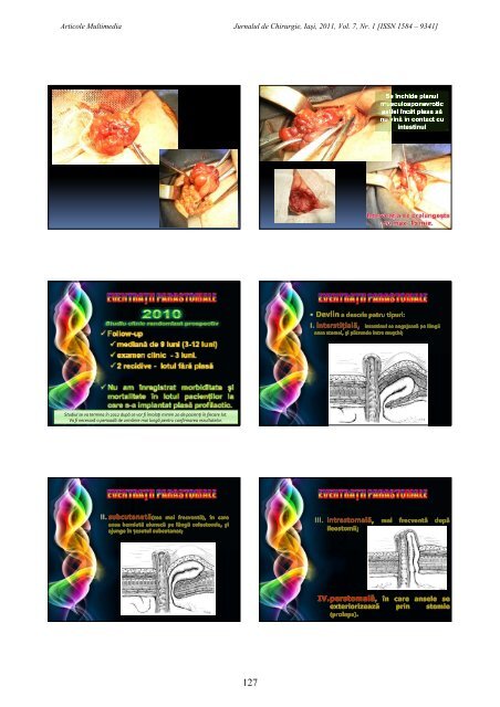 PDF (13 MB) - Jurnalul de Chirurgie