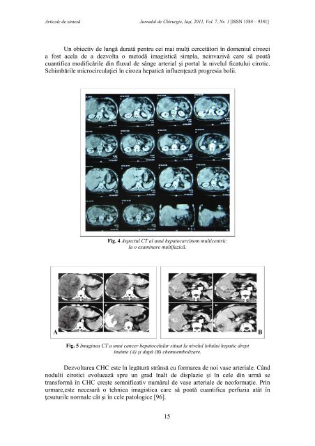 PDF (13 MB) - Jurnalul de Chirurgie