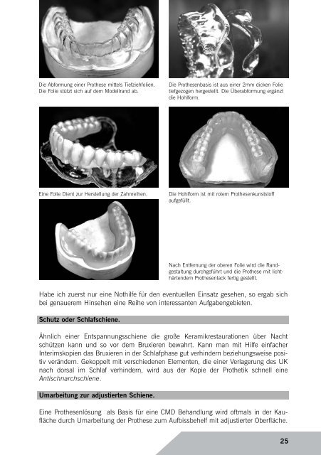 VITA Easyshade® Advance – Irren war menschlich!