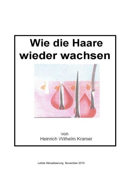 Wie die Haare wieder wachsen