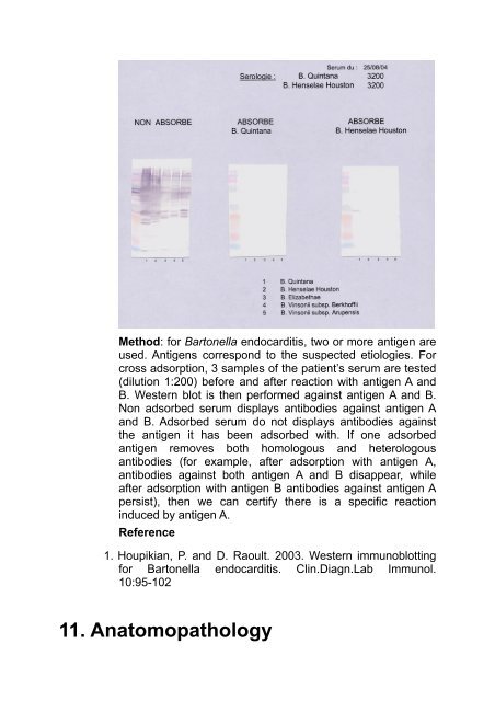 Bartonella quintana