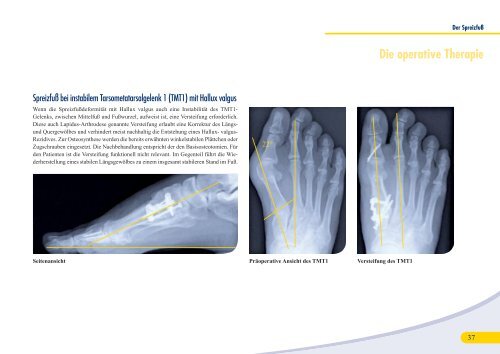 018 05-80 7112 - im Gelenkzentrum Rhein-Main