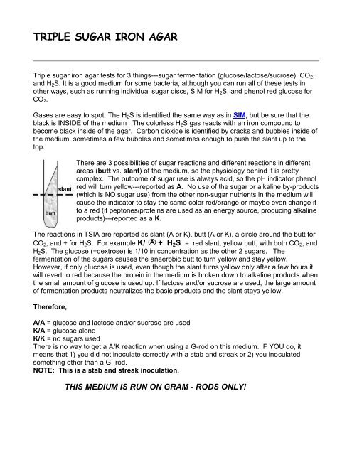 TRIPLE SUGAR IRON AGAR