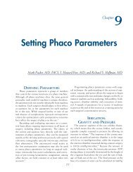 Setting Phaco Parameters