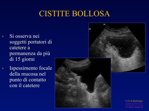 l'anatomia ecografica della vescica e della prostata per via ... - siemg