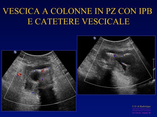 l'anatomia ecografica della vescica e della prostata per via ... - siemg