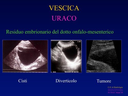 l'anatomia ecografica della vescica e della prostata per via ... - siemg