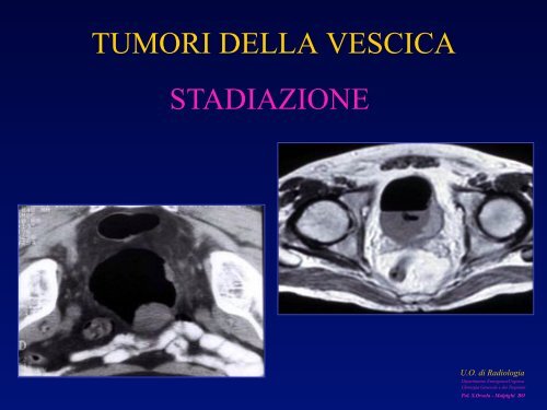 l'anatomia ecografica della vescica e della prostata per via ... - siemg