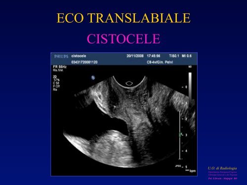 l'anatomia ecografica della vescica e della prostata per via ... - siemg