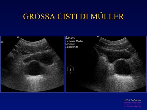 l'anatomia ecografica della vescica e della prostata per via ... - siemg