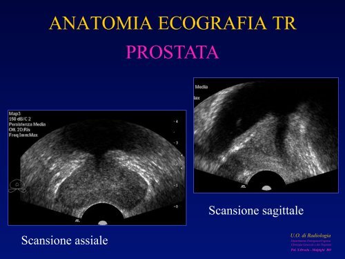 l'anatomia ecografica della vescica e della prostata per via ... - siemg