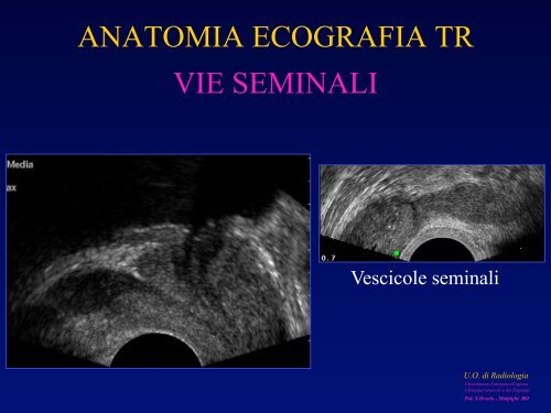 l'anatomia ecografica della vescica e della prostata per via ... - siemg