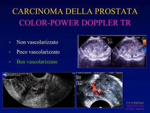 l'anatomia ecografica della vescica e della prostata per via ... - siemg