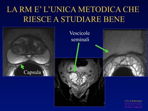 l'anatomia ecografica della vescica e della prostata per via ... - siemg