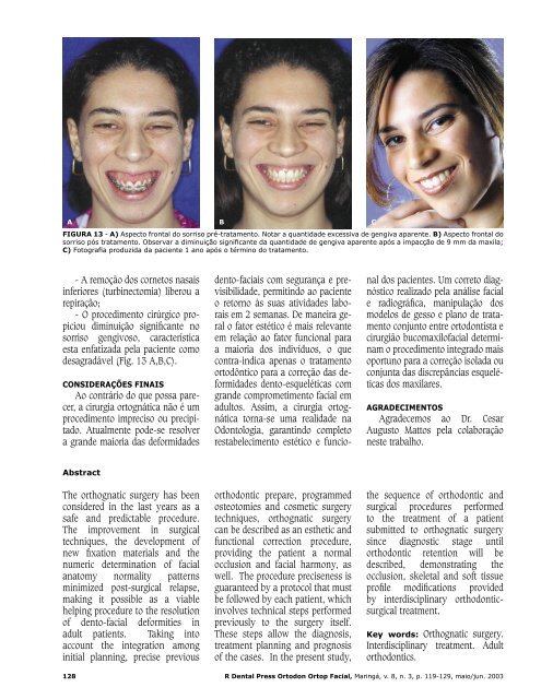 Ortodontia e Cirurgia OrtognÃ¡tica - do Planejamento ... - Dental Press