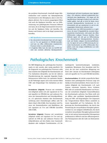 Pathologisches Knochenmark