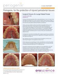 Large Palatal Fistula Closure - New Line Medical