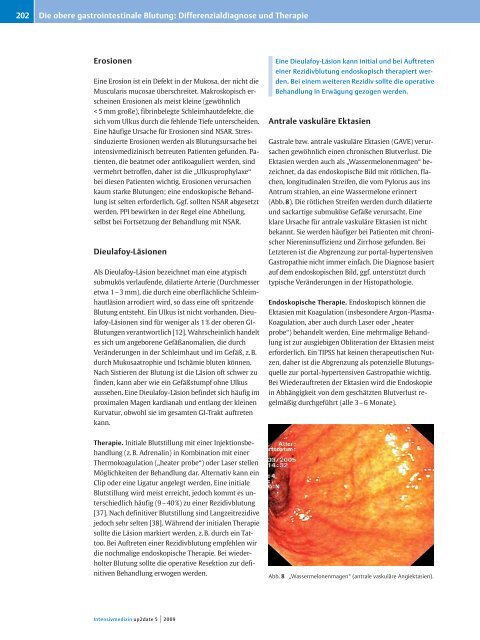 Die obere gastrointestinale Blutung: Differenzialdiagnose und ...