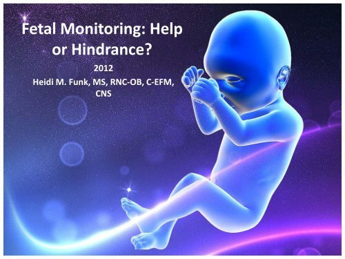 Fetal Monitoring: Help or Hindrance? - March of Dimes
