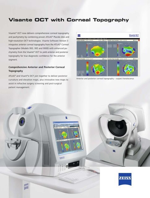 Visante OCT with Corneal Topography - Optronik