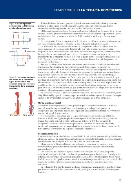 Comprendiendo la terapia compresiva - Úlceras.net