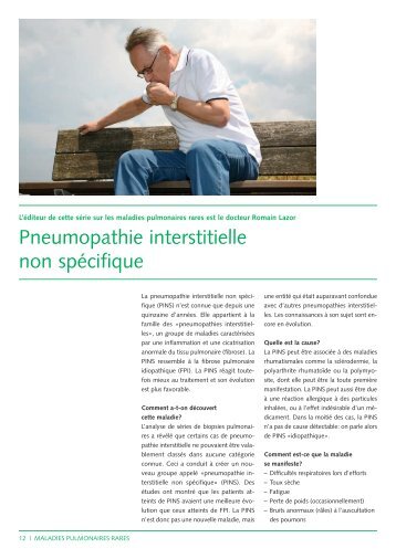 Pneumopathie interstitielle non spÃ©cifique (356Kb) - CHUV