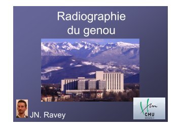 Radiographie du genou - JN Ravey