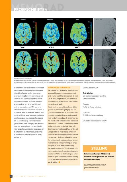 MemoRad 2007-1 - Nederlandse Vereniging voor Radiologie