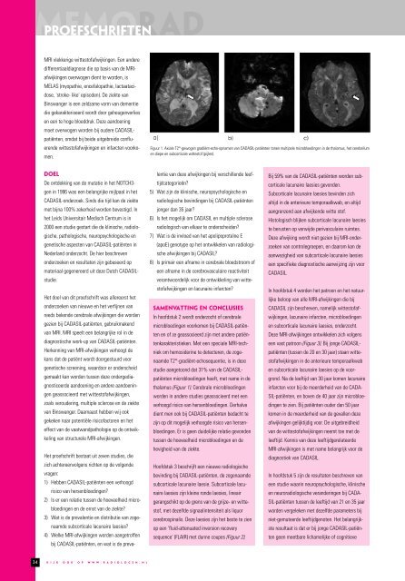 MemoRad 2007-1 - Nederlandse Vereniging voor Radiologie