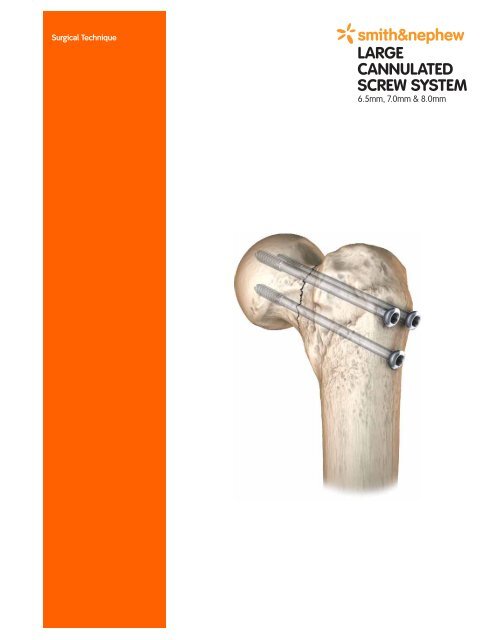 Surgical Technics Cannulated Screws.pdf - Osteosyntese