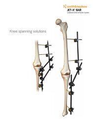 Jet-X Large Knee Spanning Solutions.pdf - Bonerepmedical.com